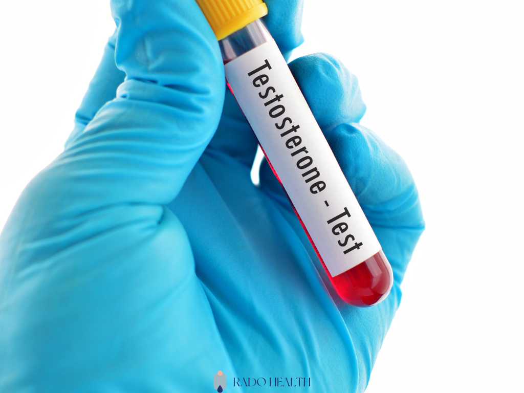 Laboratorijske vrednosti testosterona